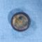 Button battery removed from the stomach